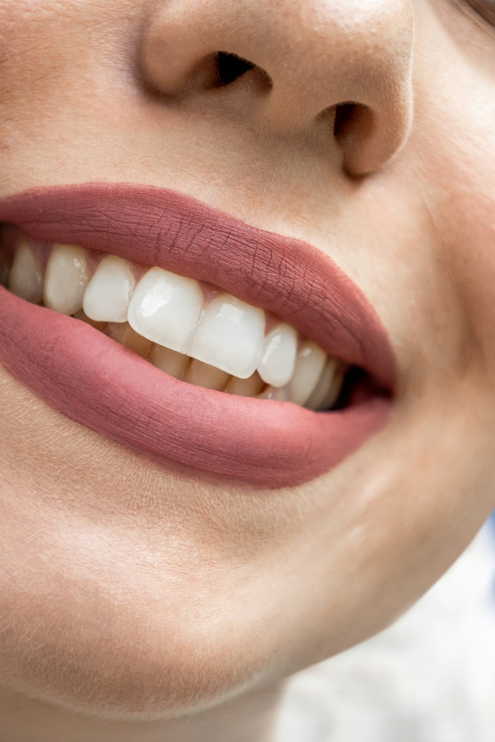 Close-up of a healthy, bright smile